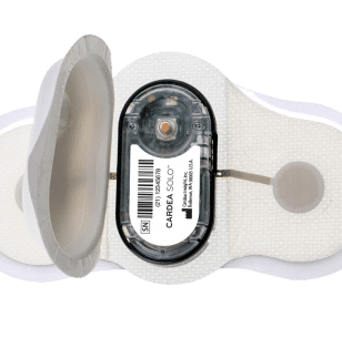 Cardea SOLO ECG System | Cardiac Insight